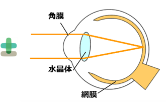 網膜上にピントが合うように調整